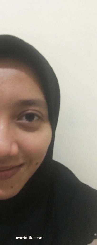 Review Masker Himalaya Purifying Neem Mask, Penolong Kulit Bruntusan dan Jerawatan azariatika before himalaya herbals neem mask 408x1024 - Review Masker Himalaya Purifying Neem Mask, Penolong Kulit Bruntusan dan Jerawatan