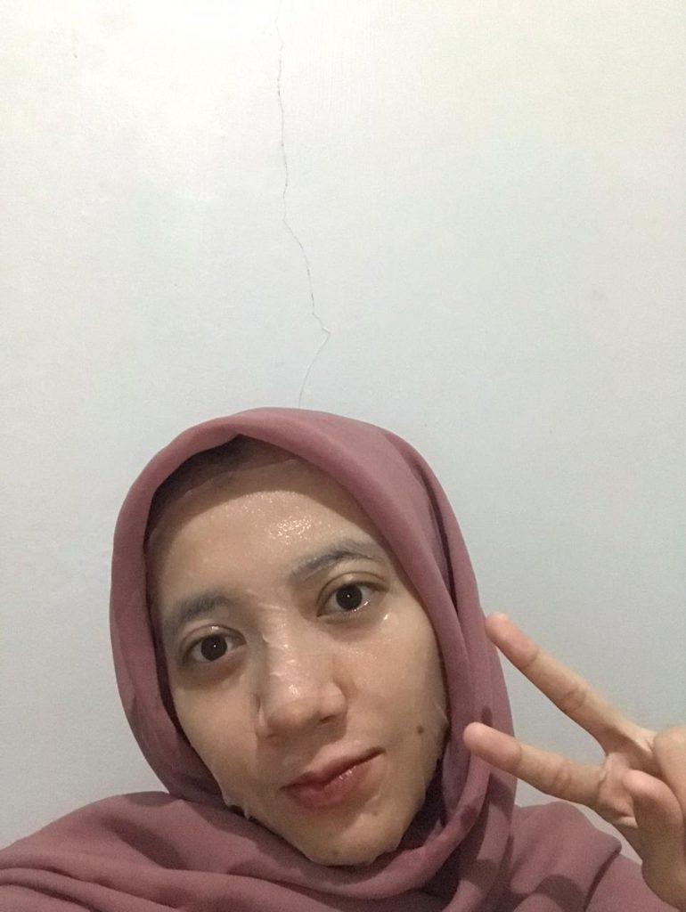 Review 3 Varian Masker Glowing LOreal Paris Revitalift Pro-Youth Face Mask, Essence-nya Melimpah! azariatika LOreal Revitalift Pro Youth Face Mask brightening 770x1024 - Review 3 Varian Masker Glowing LOreal Paris Revitalift Pro-Youth Face Mask, Essence-nya Melimpah!